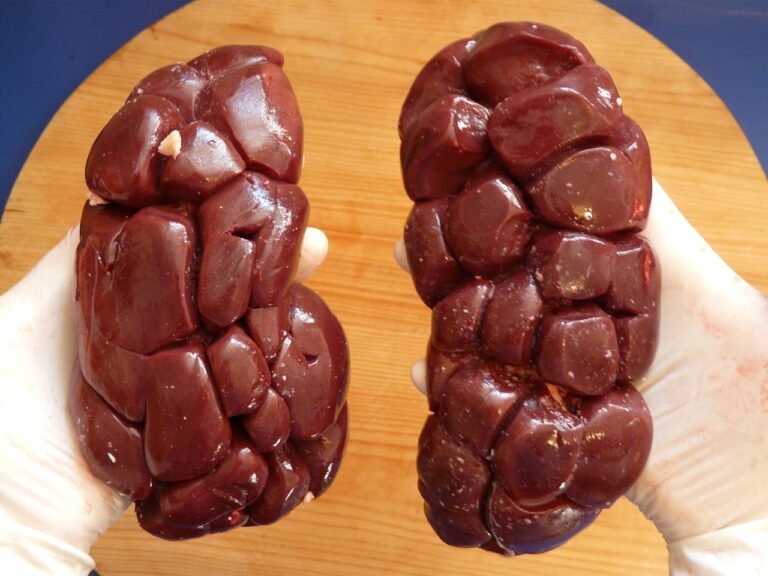 beef-kidney-6070_1280