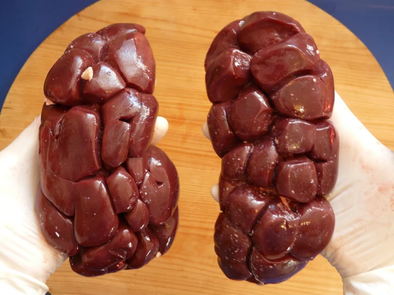 beef-kidney-6070_1280