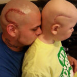 cancer-tattoo-scar-son-father-josh-mash-marshall-5-600x695-600x560