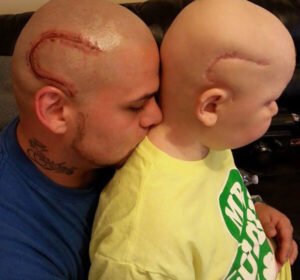 cancer-tattoo-scar-son-father-josh-mash-marshall-5-600x695-600x560