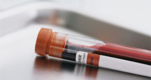 bloodtest