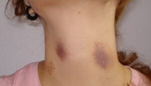 9a1f857cd77d45225e-75534863