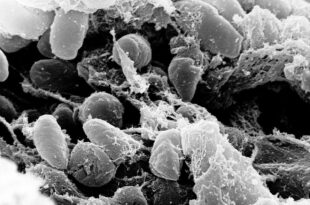 1280px Yersinia pestis