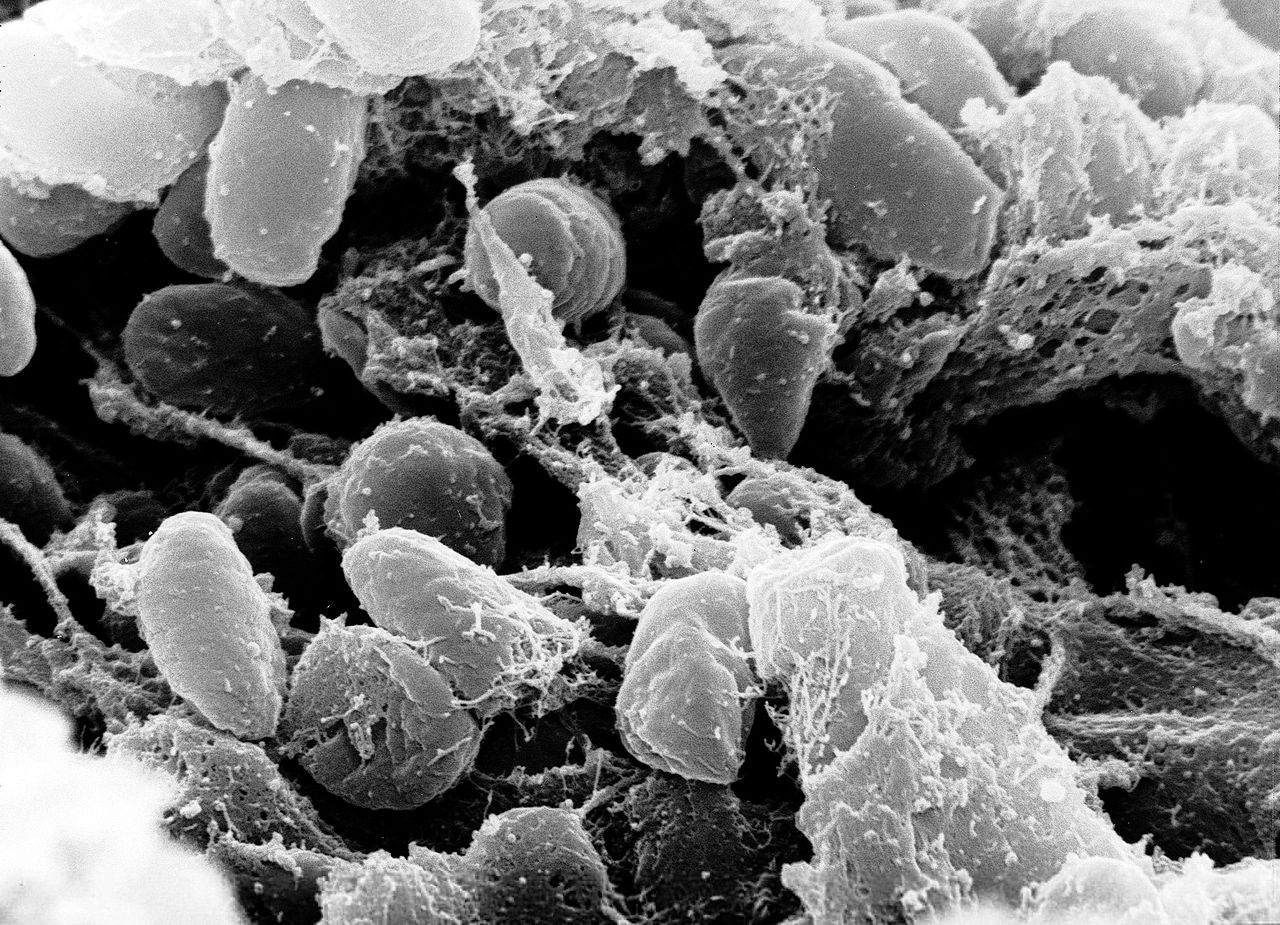 1280px-Yersinia_pestis