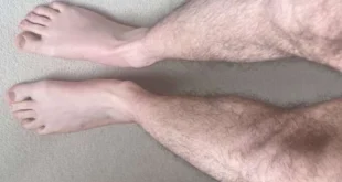 raising awareness of l