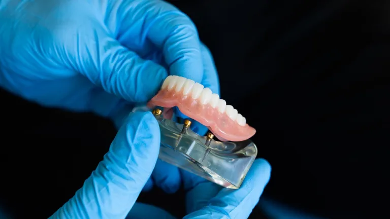 dentist-6225094_1280