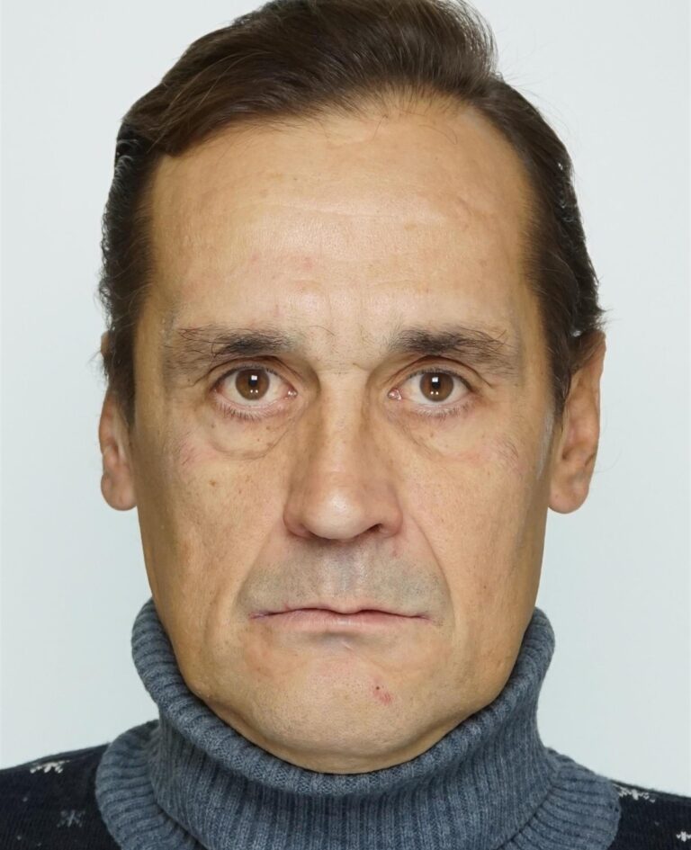 Denis