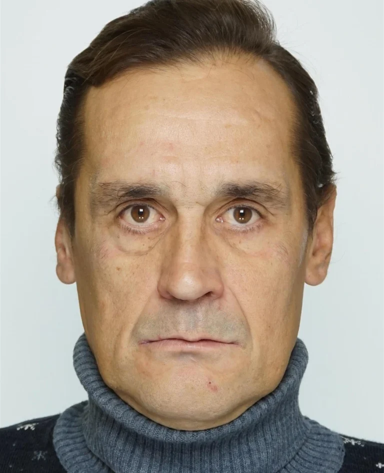Denis