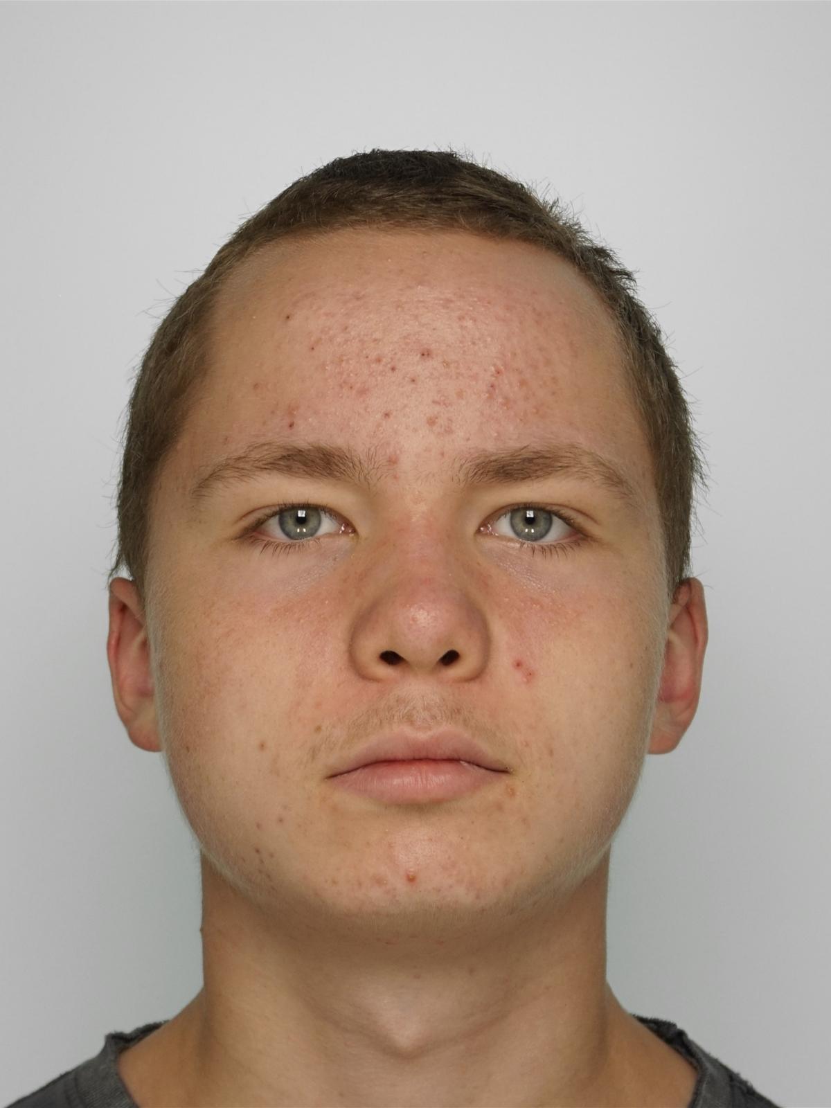 Frederik